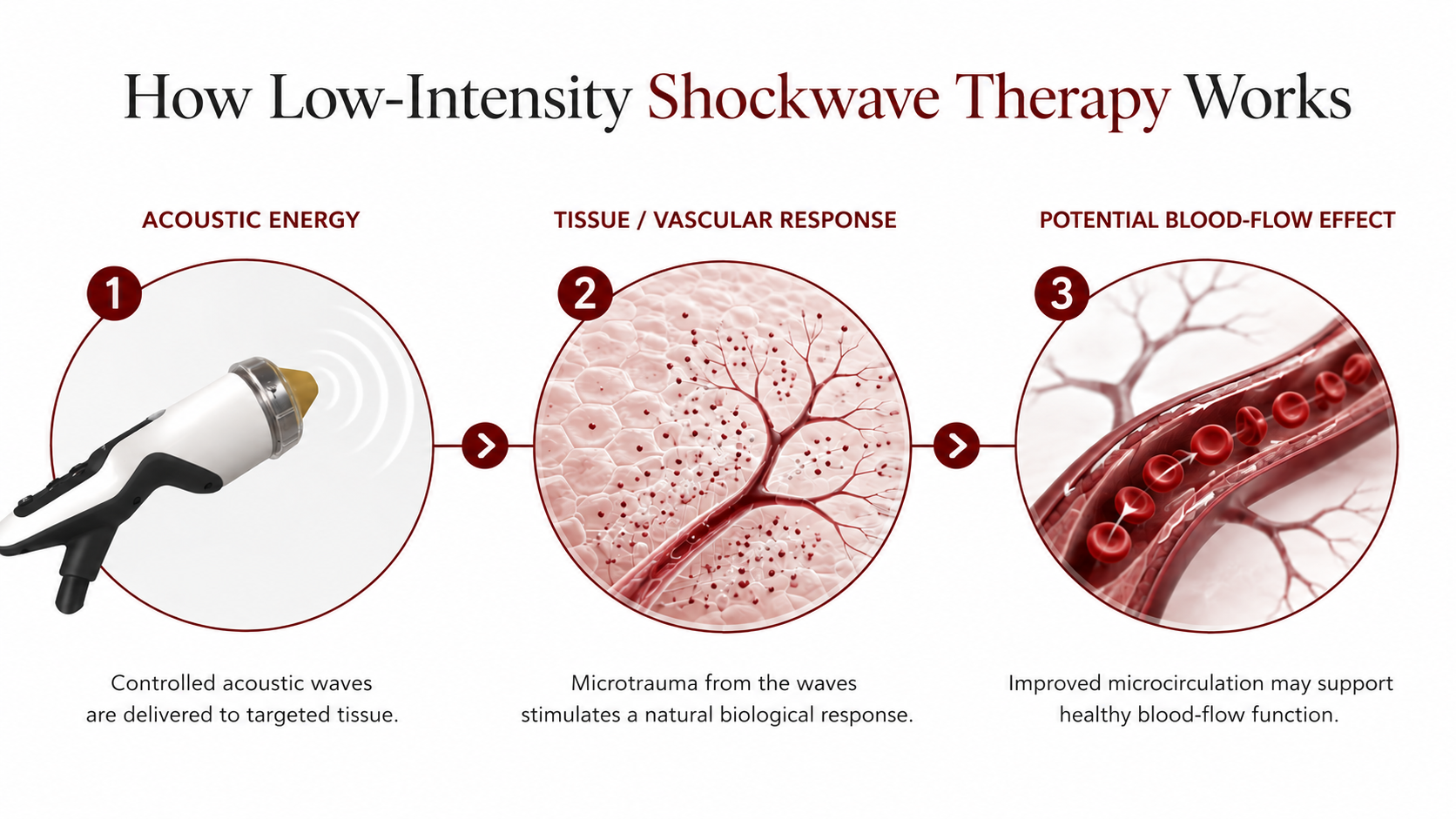 Three-step diagram: acoustic energy is delivered to targeted tissue, microtrauma stimulates a natural biological response, and improved microcirculation may support healthy blood-flow function.